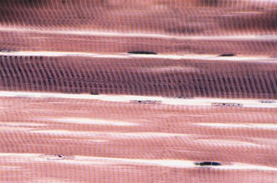 Skeletal Muscle Cells by Unknown